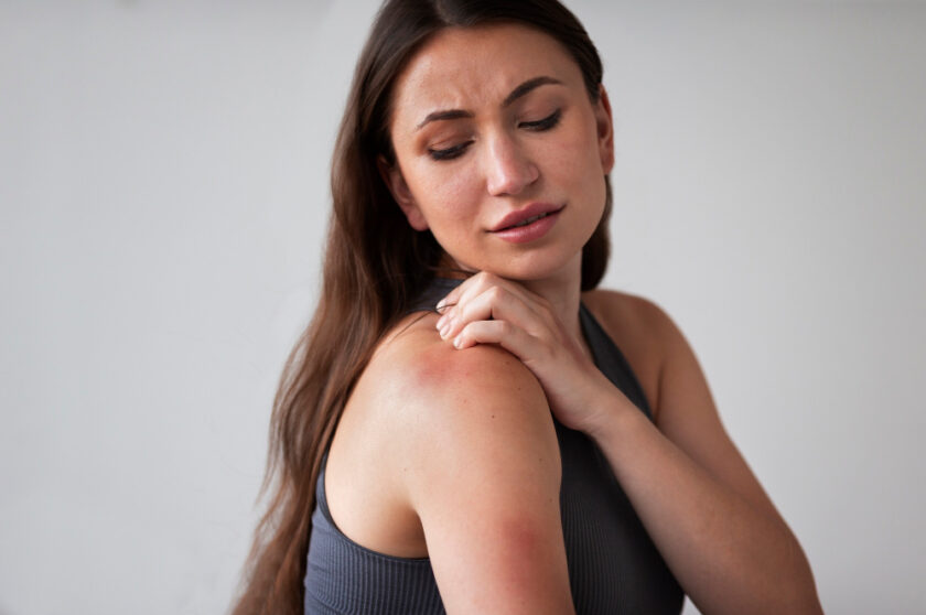 kobieta cierpiąca na atopowe zapalenie skóry